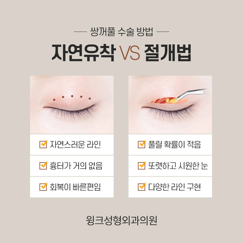 인아웃연예인은 누가 있을까? 윙크성형외과와 알아보는 쌍꺼풀 라인 종류! 관련 이미지 7