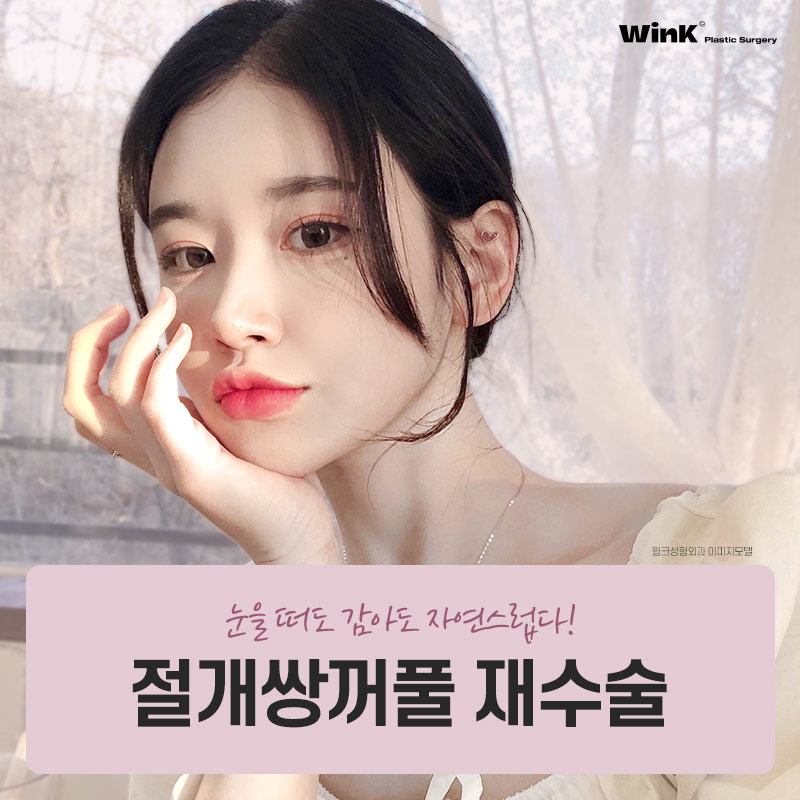 기능성과 심미성 모두 고려한 윙크성형외과 절개쌍꺼풀재수술! 관련 이미지 1