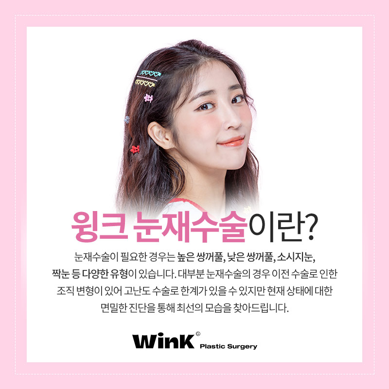 신사눈재수술후기 신사눈재수술전후 윙크성형외과 눈재수술 관련 이미지 2