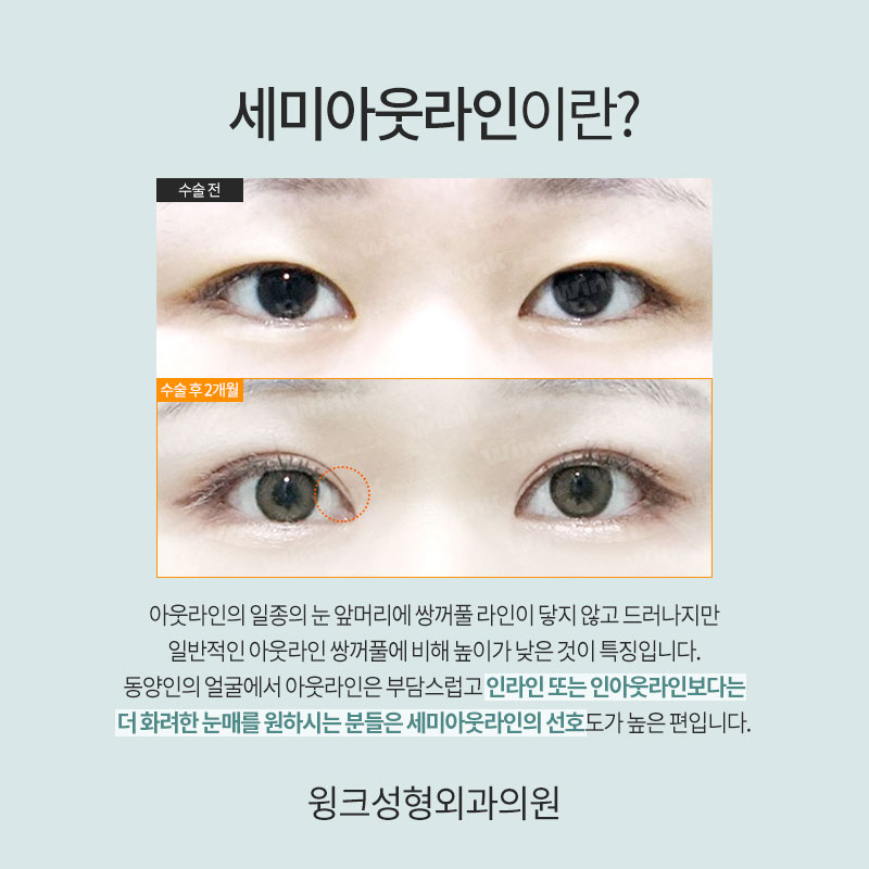 세미아웃 연예인 누가 있을까? 관련 이미지 2