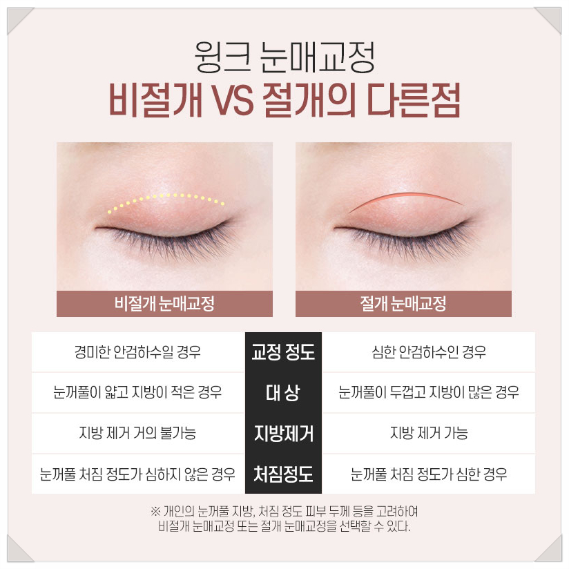 Epicanthoplasty-Free Ptosis Correction Surgery, Ptosis Surgery Without Double Eyelids, WINK Plastic Surgery, Ptosis Correction Surgery Before and After, Double Eyelid Ptosis Correction image 6