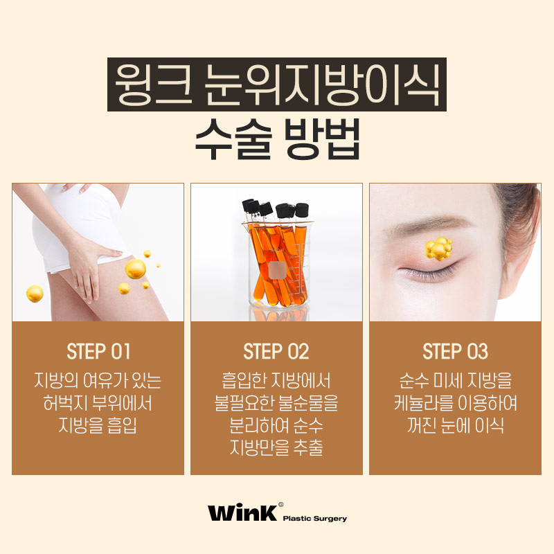 꺼진 눈, 겹주름에는 윙크성형외과 눈위지방이식으로 생기 있게! 관련 이미지 5