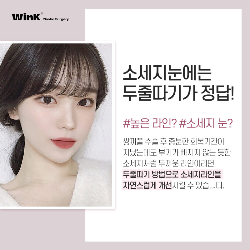 두껍고 높은 소세지눈? 윙크성형외과 두줄따기 눈재수술로 개선 관련 이미지 3