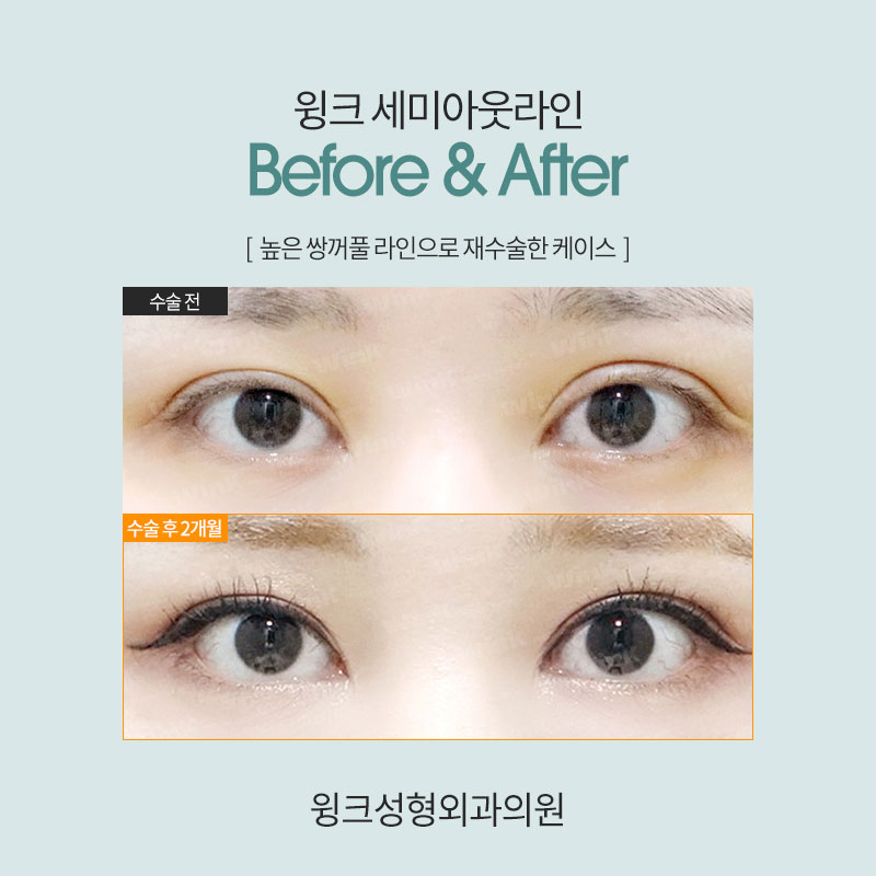 세미아웃 연예인 누가 있을까? 관련 이미지 5