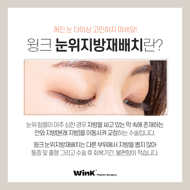 Lift Tired-Looking Eyelids with Upper Eyelid Fat Repositioning at Wink Plastic Surgery! image 2