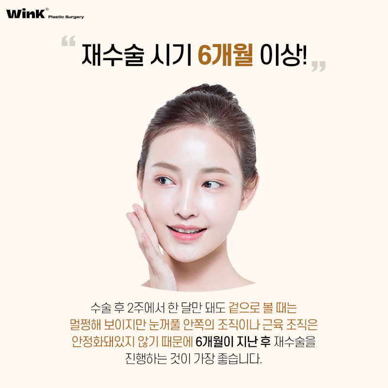 과도한 트임으로 부자연스러운 눈, 윙크성형외과 트임복원술로 해결하자! 관련 이미지 7