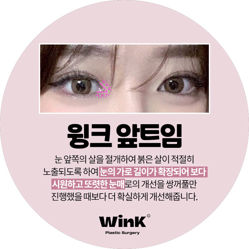 윙크성형외과 앞트임 답답한 눈매를 시원하게 관련 이미지 2