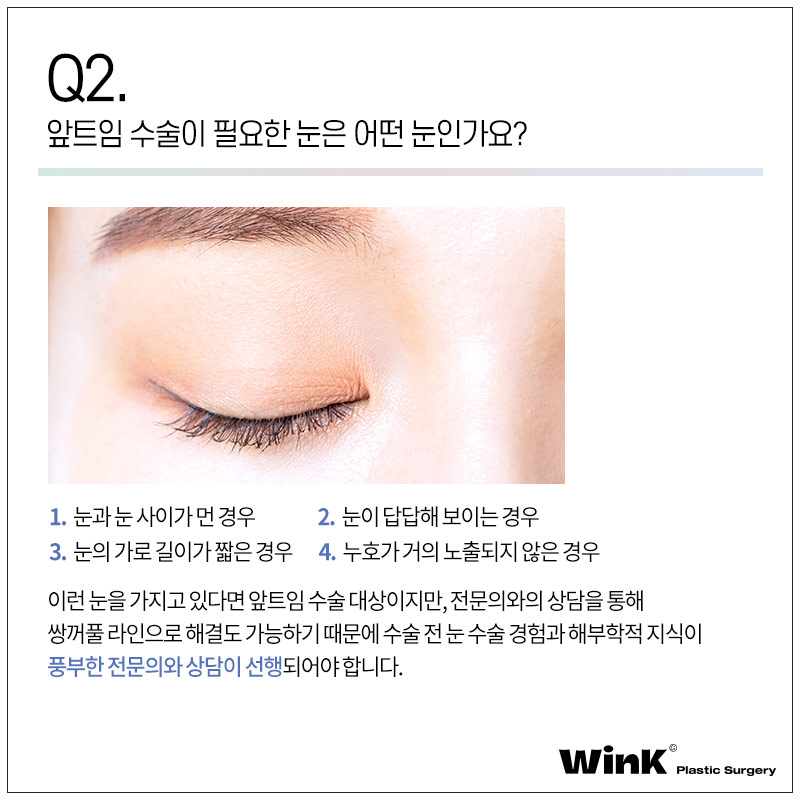 윙크성형외과에서 알려드리는 트임에 관한 모든 것! 관련 이미지 4