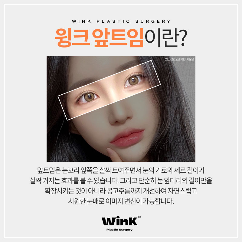 트임맛집 알아보고 있다면 윙크성형외과 신사앞트임비용 관련 이미지 3