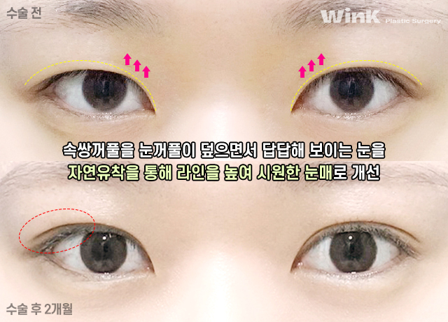 A Natural, Smooth Curved Line That Suits My Eyes! image 9