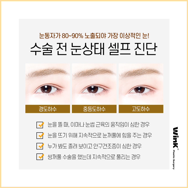 Wink Plastic Surgery’s Non-Incisional Ptosis Correction for Clearer Eyes Without an Incision! image 5