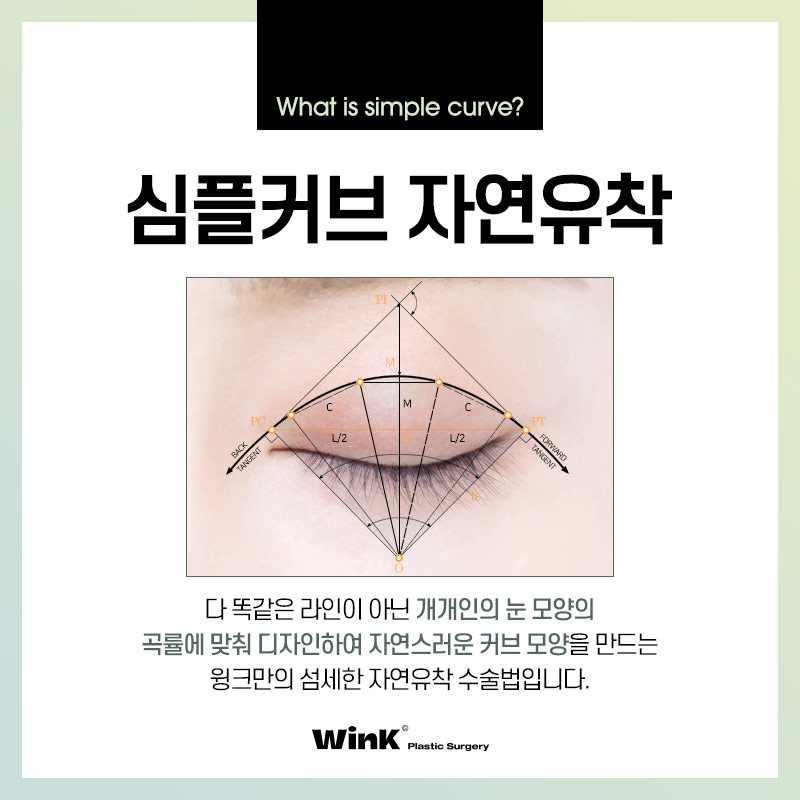 윙크성형외과만의 심플커브 자연유착으로 자연스럽고 매끈한 곡선 라인! 관련 이미지 2