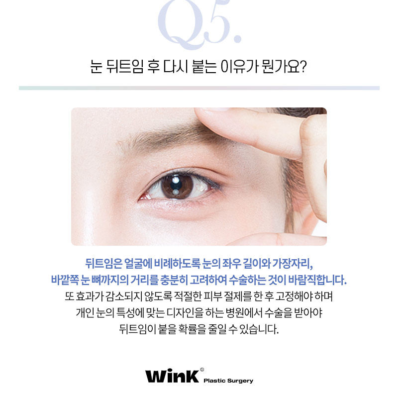 트임성형의 모든것! 눈밑트임잘하는곳 신사트임잘하는곳 관련 이미지 7