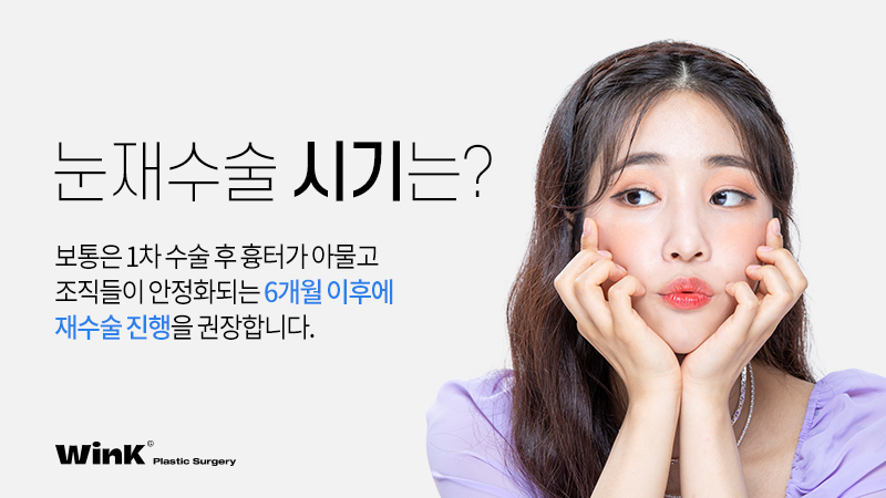 높은 쌍꺼풀 라인, 겹쌍꺼풀과 같은 유형의 눈재수술 방법은? 관련 이미지 5