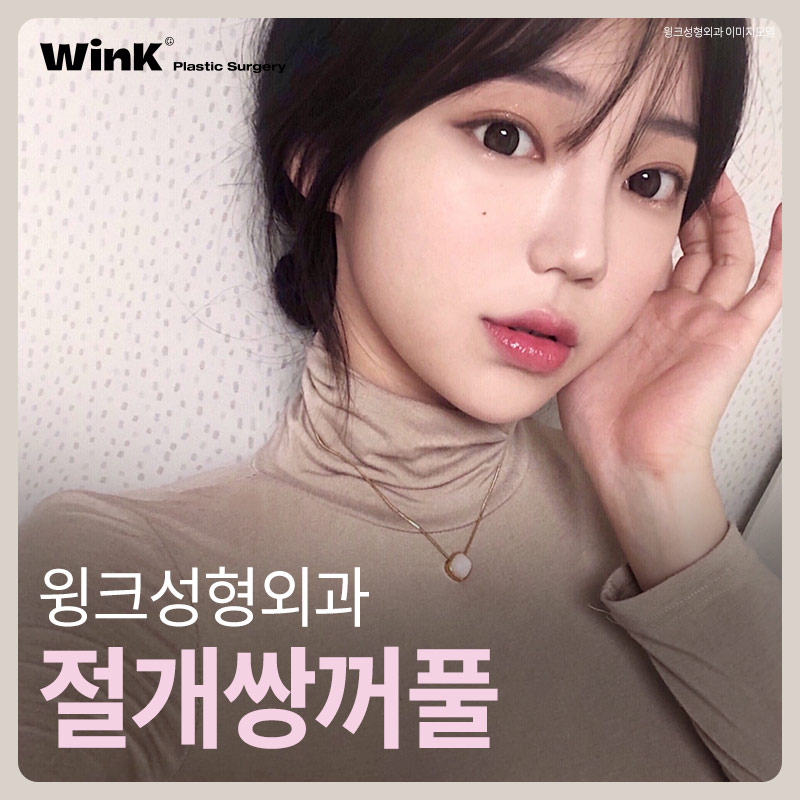윙크성형외과 절개쌍꺼풀 풀리지 않고 또렷하게 관련 이미지 6