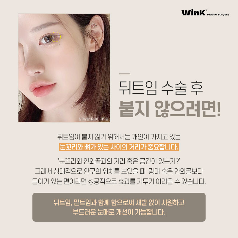 Does Lateral Canthoplasty Always Reattach? How to Minimize Side Effects of Lateral Canthoplasty, as Explained by Wink Plastic Surgery! image 3