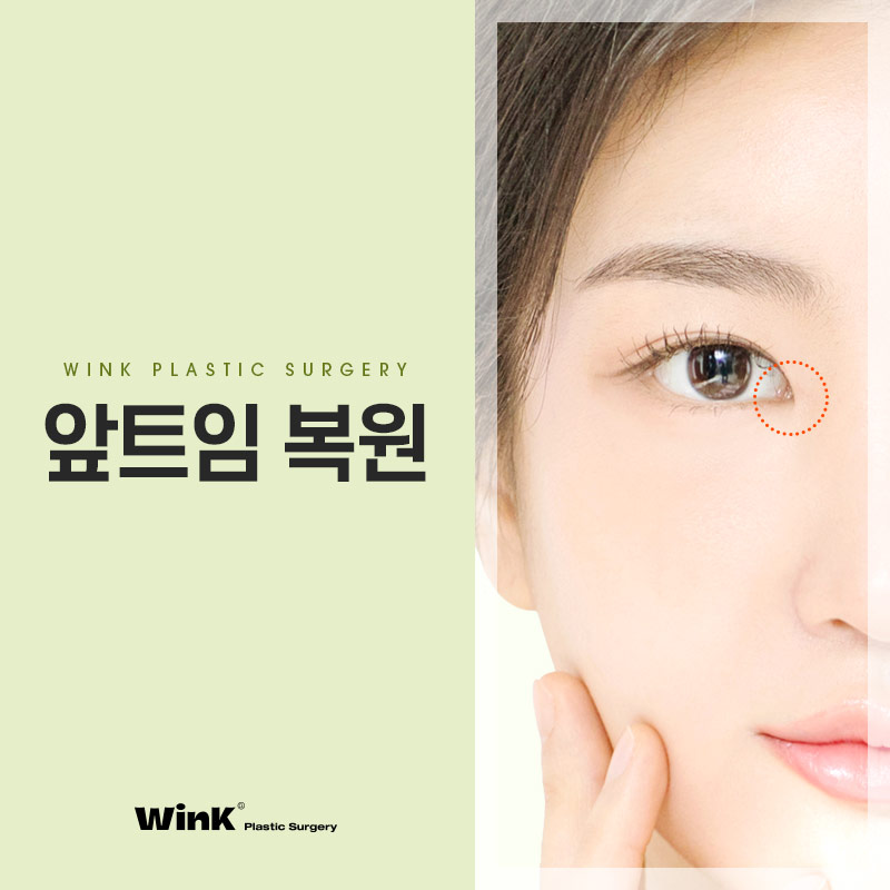 트임복원) 과도하게 트인 앞트임부작용을 앞트임복원으로 깔끔하고 자연스러운 결과 관련 이미지 1