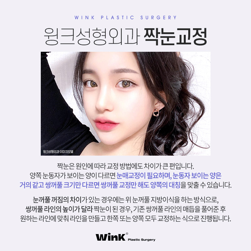 Asymmetrical Eyes and Eye Asymmetry Correction Explained by Wink Plastic Surgery image 3