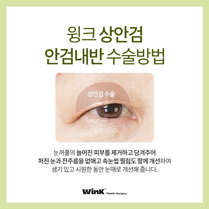 안검내반 윙크성형외과 상안검으로 기능적+미용적 동시에 해결 관련 이미지 5