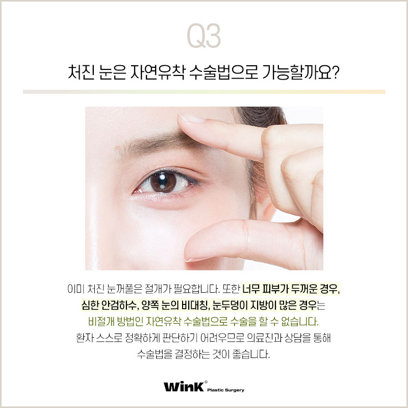 What Are the Differences Between Natural Adhesion and Buried Double Eyelid Surgery? Everything You Need to Know About Natural Adhesion, as Told by Wink Plastic Surgery! image 4