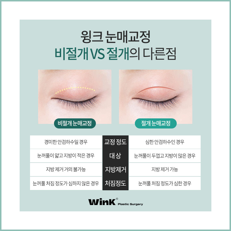 적절한 눈동자 노출로 더욱더 또렷한 눈매로! 관련 이미지 6