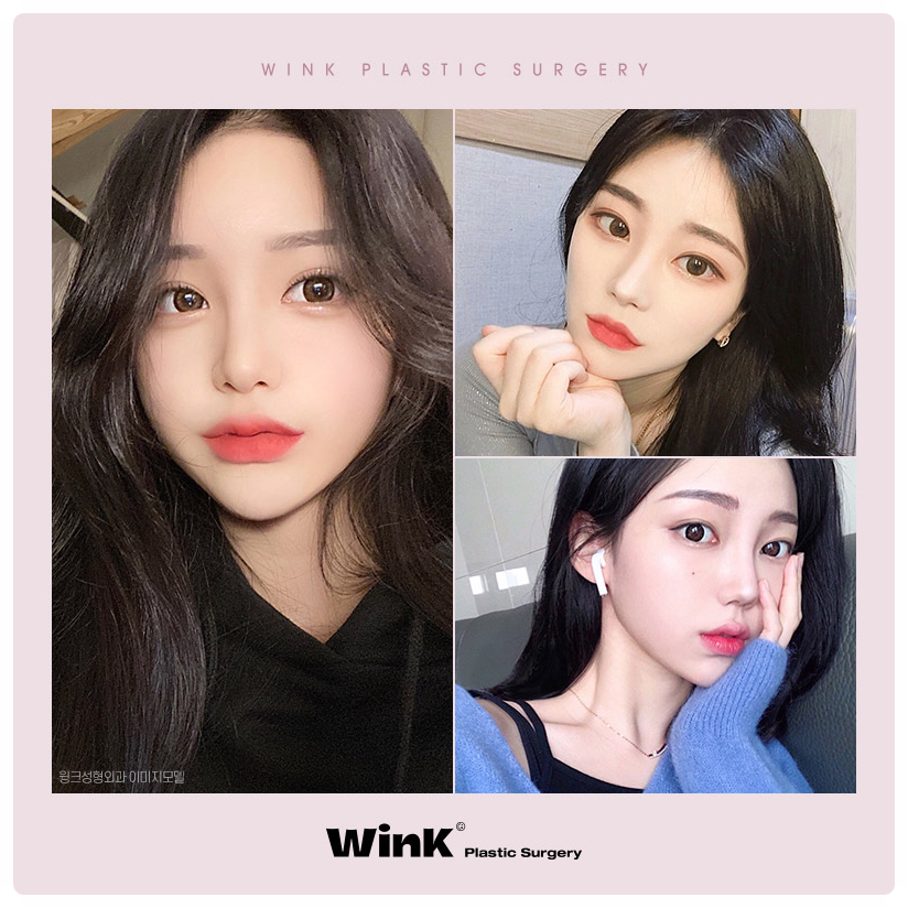 Types of Eye Corner Surgery: Reviews of Epicanthoplasty, Upper Canthoplasty, Canthoplasty Before and After, Lower Canthoplasty Price, and Wink Plastic Surgery image 6