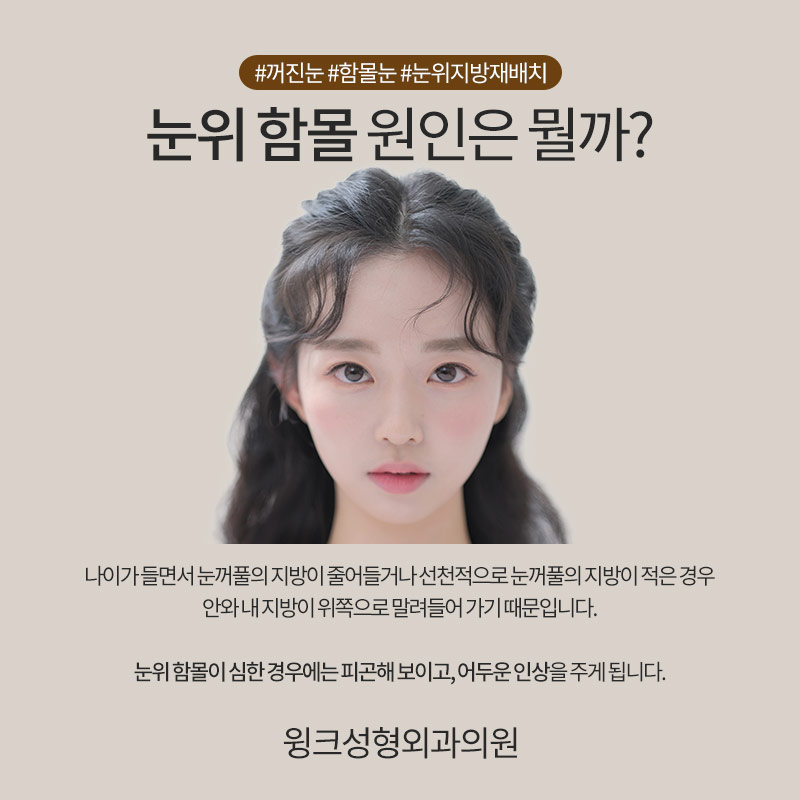 눈위지방재배치 눈지방재배치 꺼진 눈꺼풀을 생기 가득하게! 관련 이미지 3