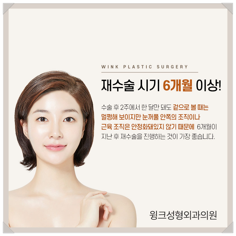 Recovery Period After Epicanthoplasty Restoration, Epicanthoplasty Scar, If You’re Only Looking Into Epicanthoplasty, Wink Plastic Surgery image 6