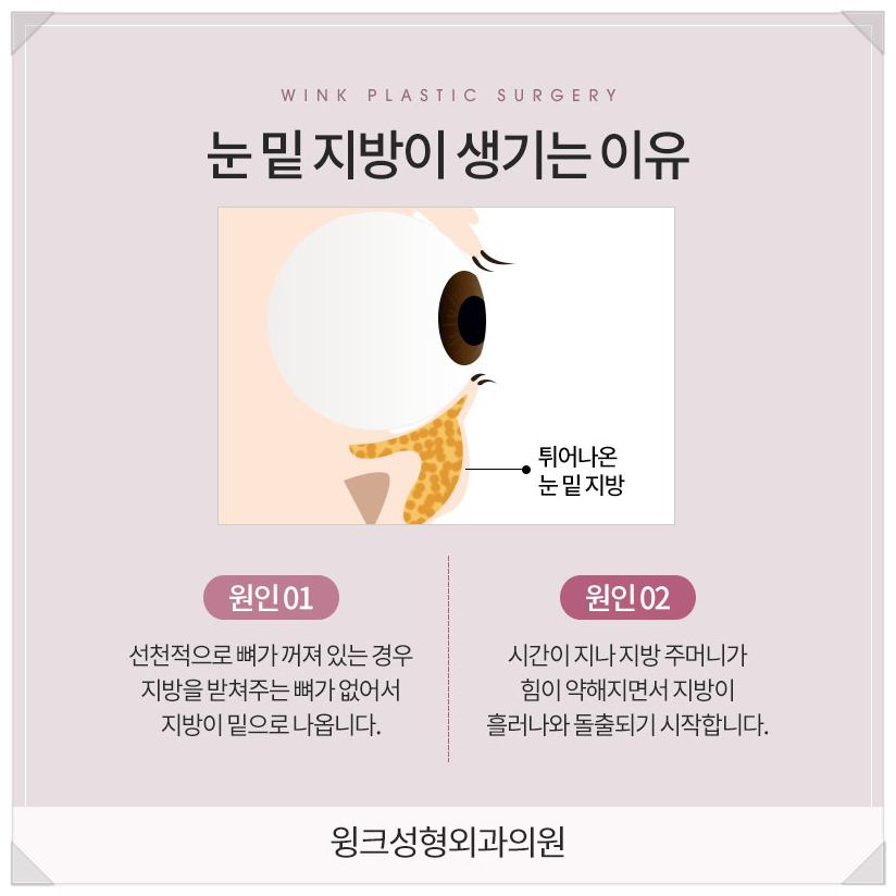 눈밑지방재배치가격좋은곳 눈밑지방재배치병원 눈밑지후기 찾는다면 윙크성형외과 관련 이미지 3