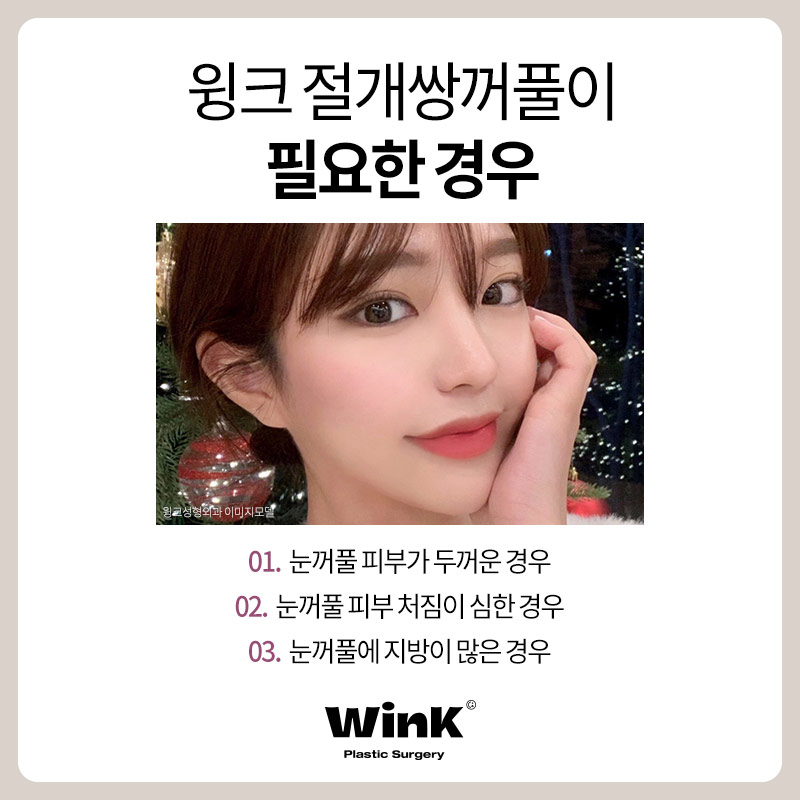 윙크성형외과 절개쌍꺼풀 풀리지 않고 또렷하게 관련 이미지 5