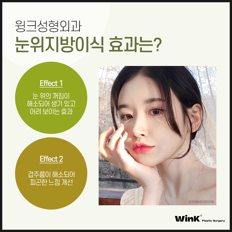 Sunken Upper-Eyelid Fat Graft Price | Wink Plastic Surgery | Eyelid Fat Grafting | Sunken Eyelid Surgery | Sinsa Upper-Eyelid Fat Graft Review image 6