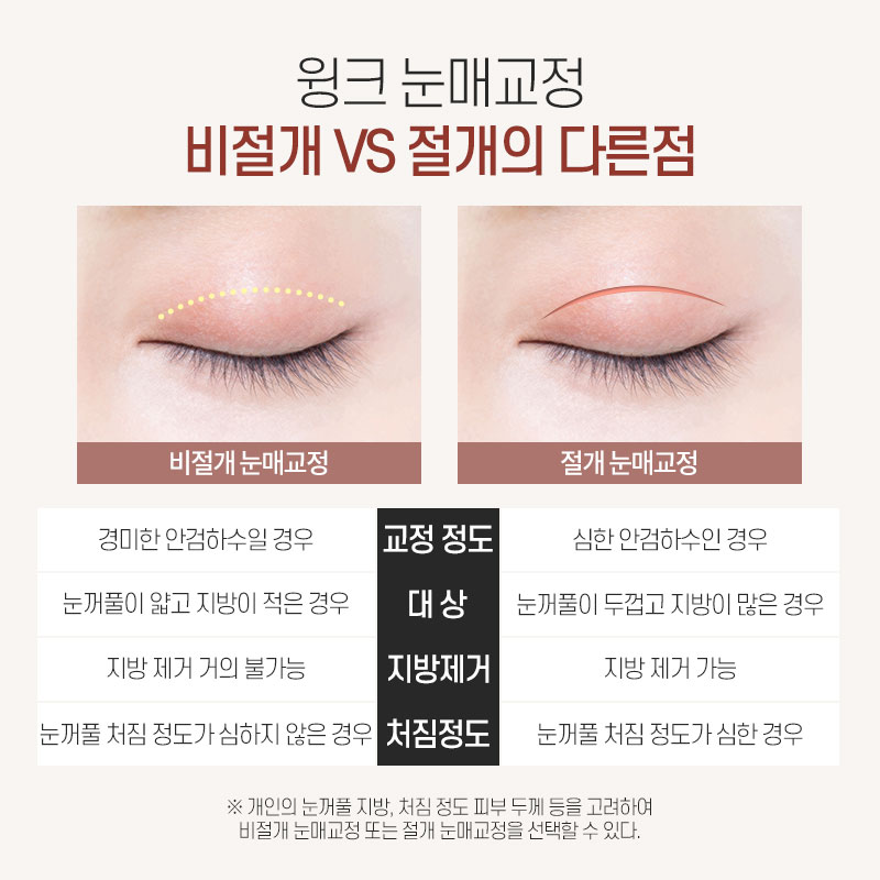 윙크 무쌍 눈매교정으로 쌍꺼풀 라인 없이  또렷한 눈매! 관련 이미지 6