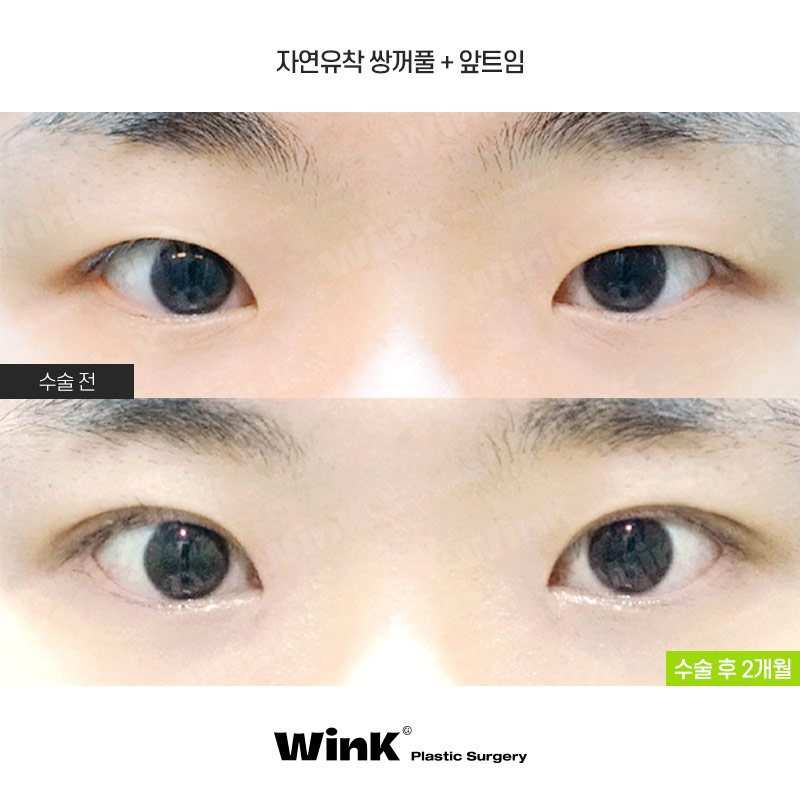 Wink Simple Curve Natural Adhesion for a Natural, Defined Line! image 1