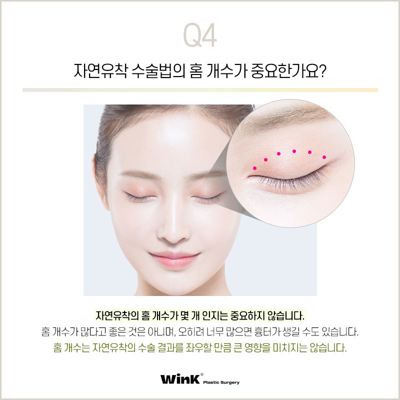 What Are the Differences Between Natural Adhesion and Buried Double Eyelid Surgery? Everything You Need to Know About Natural Adhesion, as Told by Wink Plastic Surgery! image 6