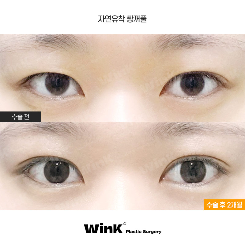 A Natural, Smooth Curved Line That Suits My Eyes! image 1