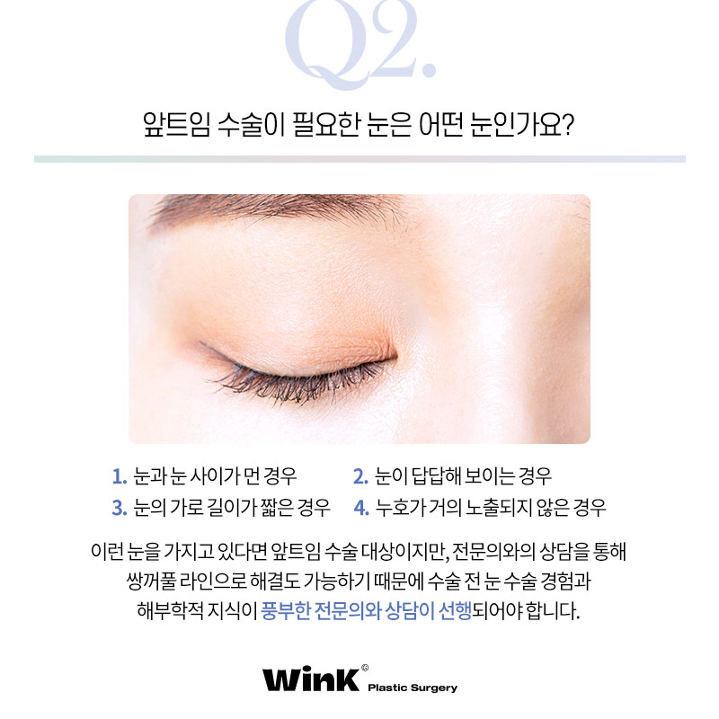 트임성형의 모든것! 눈밑트임잘하는곳 신사트임잘하는곳 관련 이미지 4