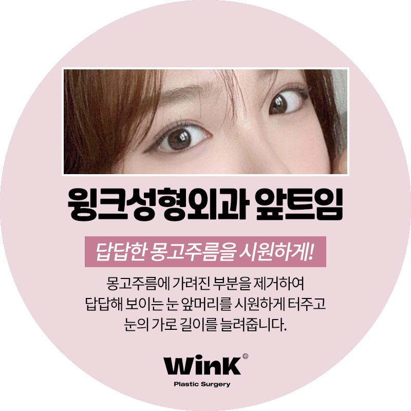 윙크성형외과 앞트임 답답한 눈매를 시원하게 관련 이미지 5