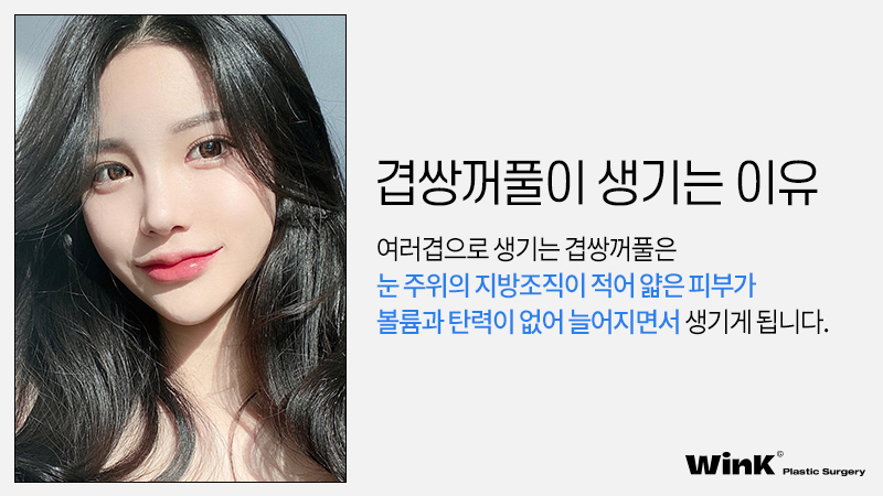 높은 쌍꺼풀 라인, 겹쌍꺼풀과 같은 유형의 눈재수술 방법은? 관련 이미지 8