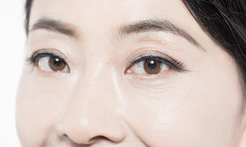 Let’s Take a Look at What to Watch Out for When Planning Double Eyelid Surgery in Middle Age. image 3