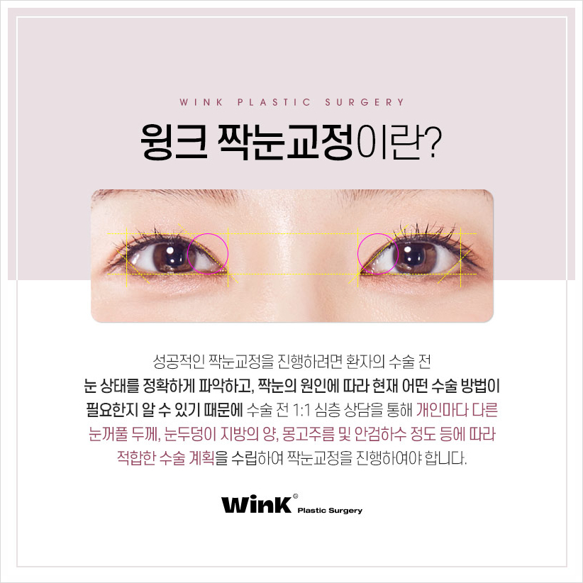 눈짝짝이 짝짝이눈 고민이라면 윙크성형외과 짝눈수술 짝눈교정전후 관련 이미지 4