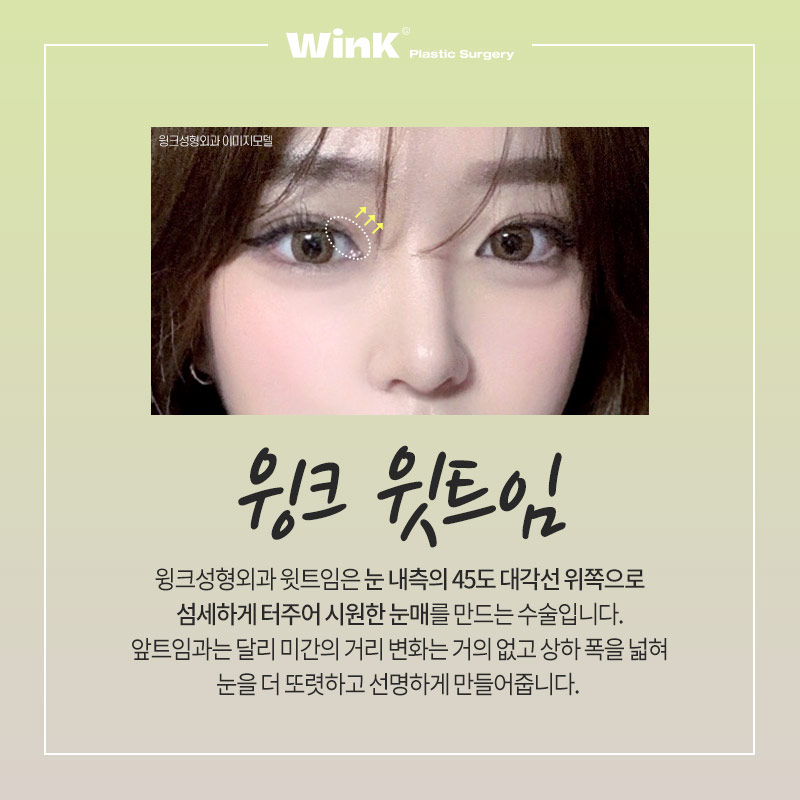 신사윗트임잘하는곳 찾고 있다면? 신사역윗트임후기 알아보자 관련 이미지 2