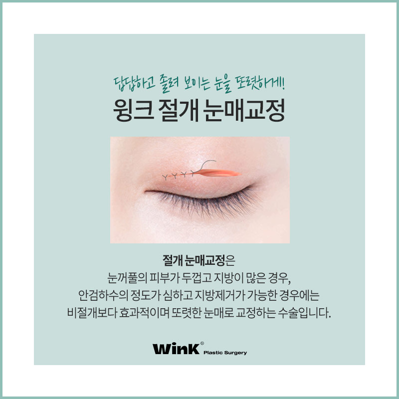 적절한 눈동자 노출로 더욱더 또렷한 눈매로! 관련 이미지 7