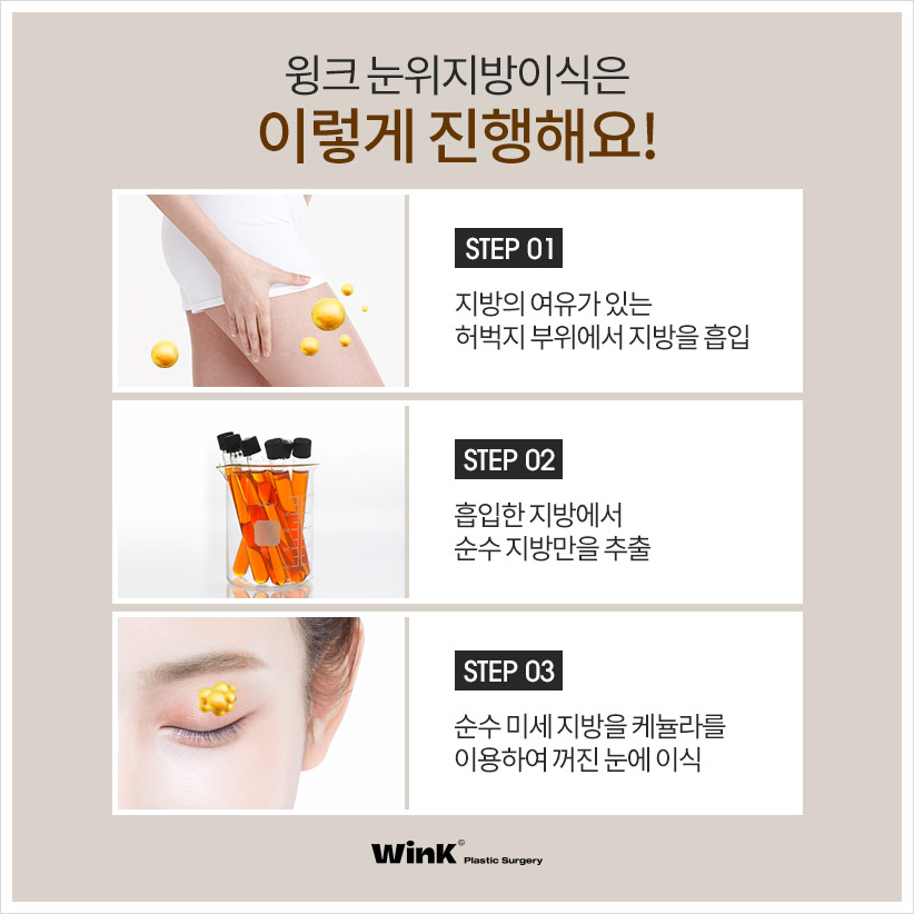 If You're Curious About Upper Eyelid Fat Grafting Reviews: Wink Plastic Surgery, Sinsa Upper Eyelid Fat Grafting Price, and Before-and-After for Hollow Eyes image 2