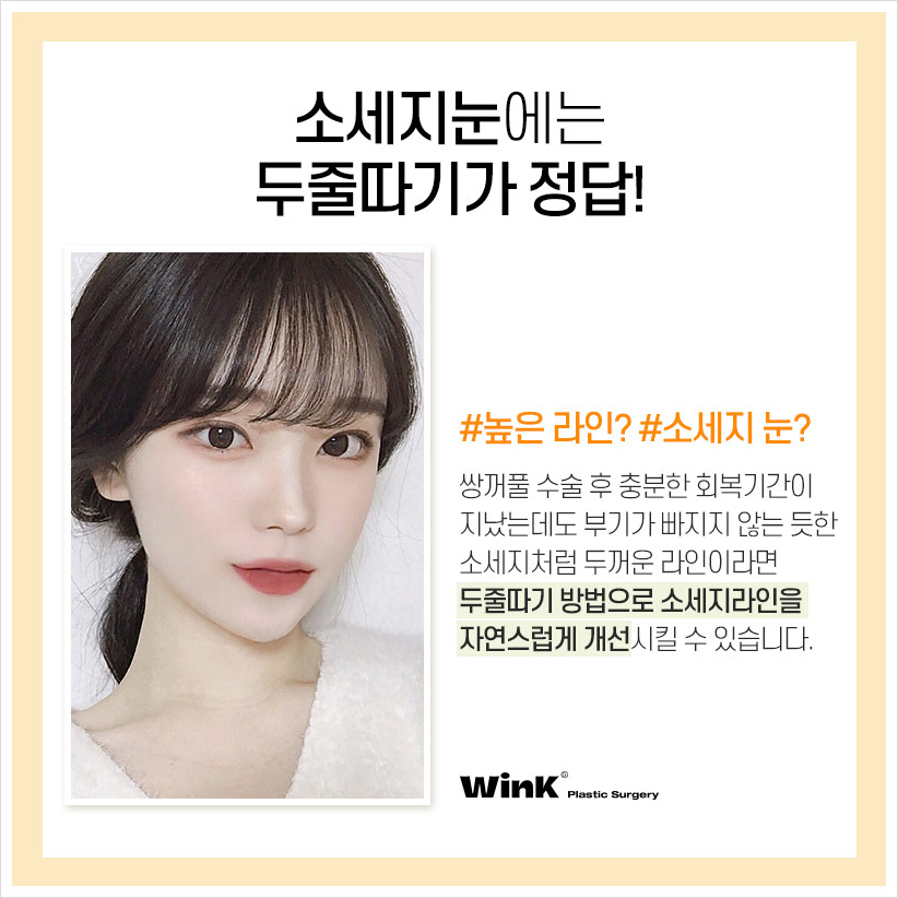 Sausage Eyes After Double Eyelid Surgery: If You’re Concerned About a Bulky Double Eyelid, Wink Plastic Surgery’s Double Eyelid Line Lowering and Sausage Eye Revision Surgery Costs image 3