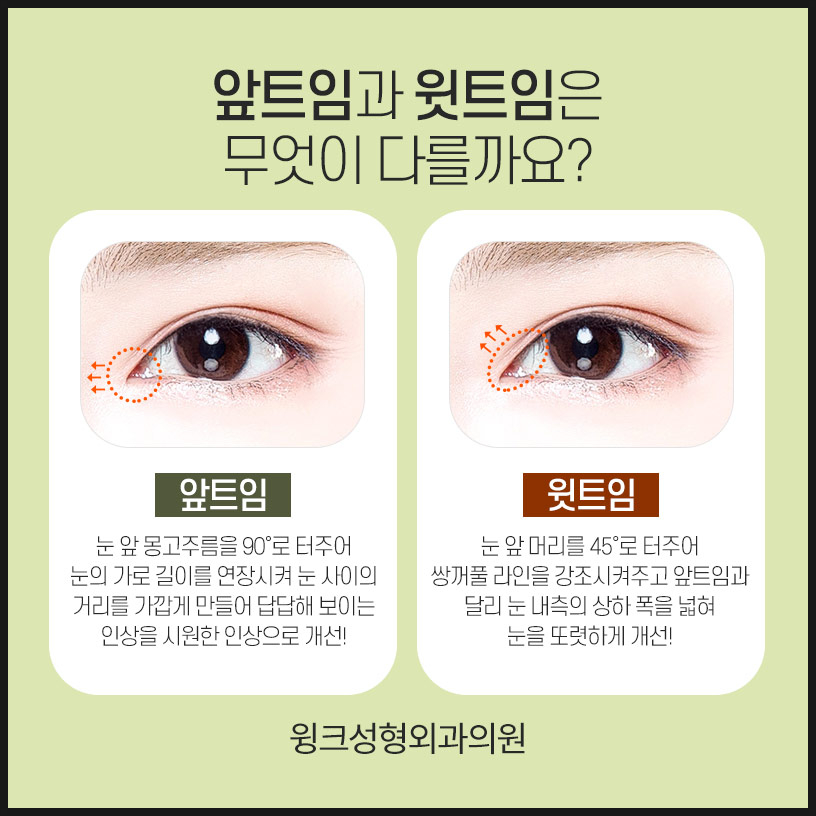 트임성형 윗트임으로 전체적으로 눈을 시원하게! 관련 이미지 4