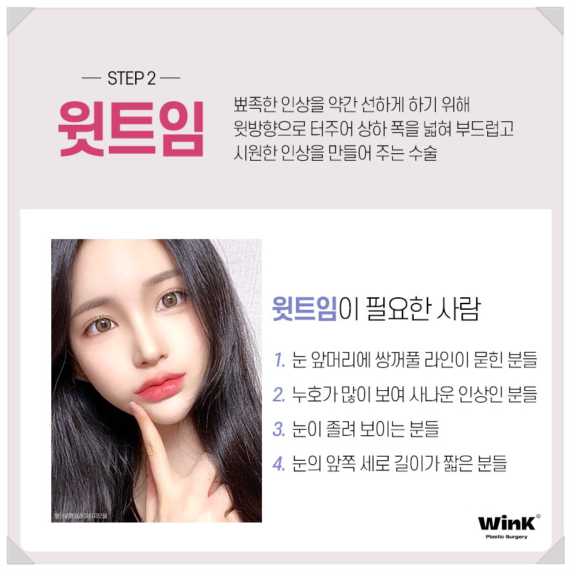 If You’re Looking Into Eye Widening Procedures: Wink Plastic Surgery’s Epicanthoplasty Price, Upper Canthoplasty Before and After, Rear Canthoplasty Reviews, and Where to Get Lower Canthoplasty Well Done image 4