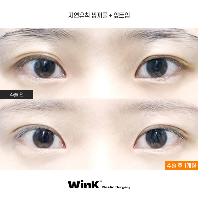 Natural-looking and long-lasting with WINK’s own natural adhesion! image 1
