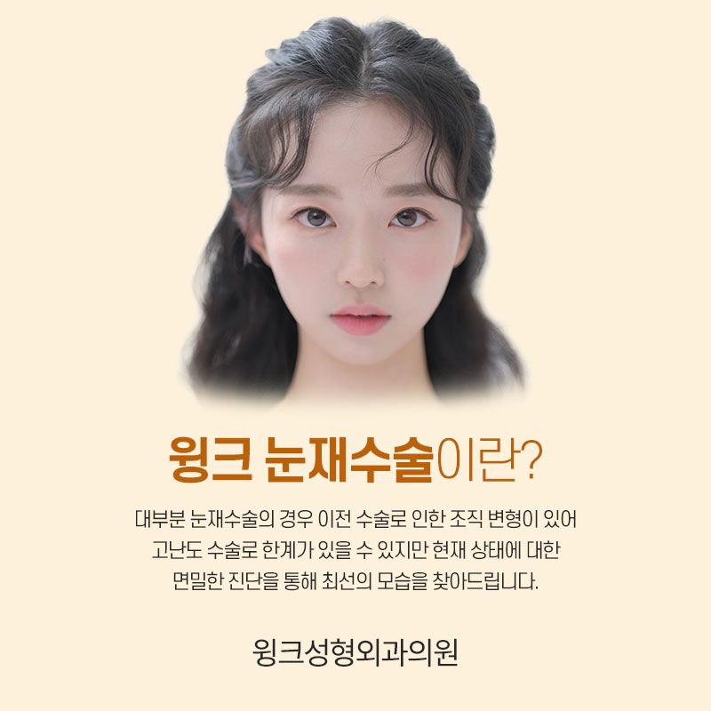 절개쌍꺼풀 재수술 시 알아야 둬야 할 것은 무엇일까요? 관련 이미지 2