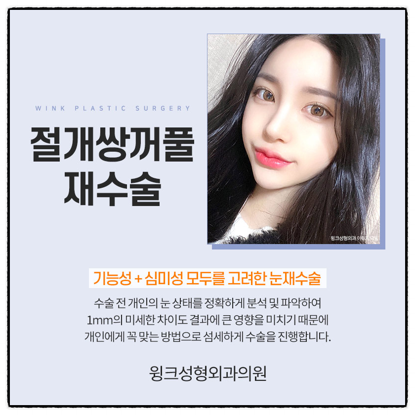 쌍꺼풀절개재수술 절개쌍수재수술후기로 흉터부터 회복까지 알아보자! 관련 이미지 2