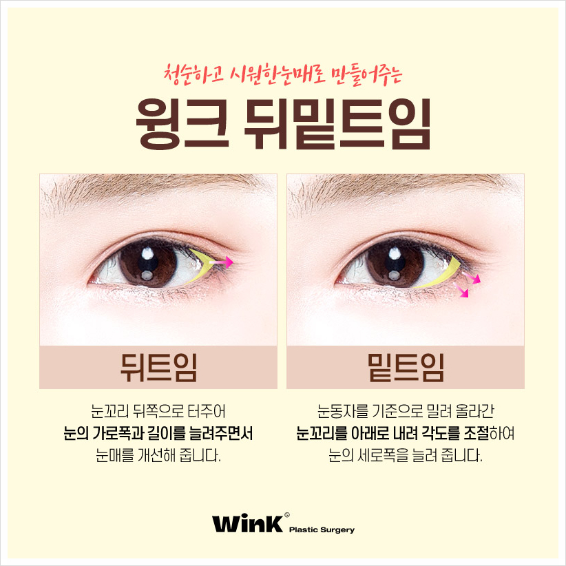 뒤밑트임비용 신사뒤밑트임후기 뒤밑트임잘하는곳 찾고 있다면 윙크성형외과 관련 이미지 3